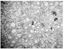 Hoelzel, S.C. da S.M., A.F. Morel, G.D. Zanetti, M.P. Manfron & C. Schmidt Figura 5. Secção transversal da raiz de Waltheria douradinha, região medular; 1) xilema, 2) esclerênquima.