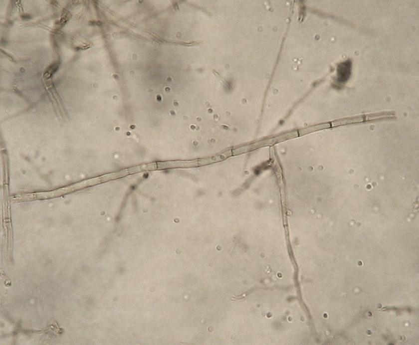 Pode-se observar escurecimento das raízes devido à associação com o fungo.