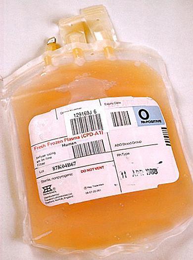 Qual é a constituição do sangue? O sangue é constituído por: É o componente líquido e não celular do sangue.