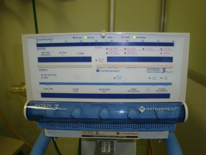 A bomba de infusão é um aparelho que leva a medicação na quantidade e na hora certa para o bebê ou criança.