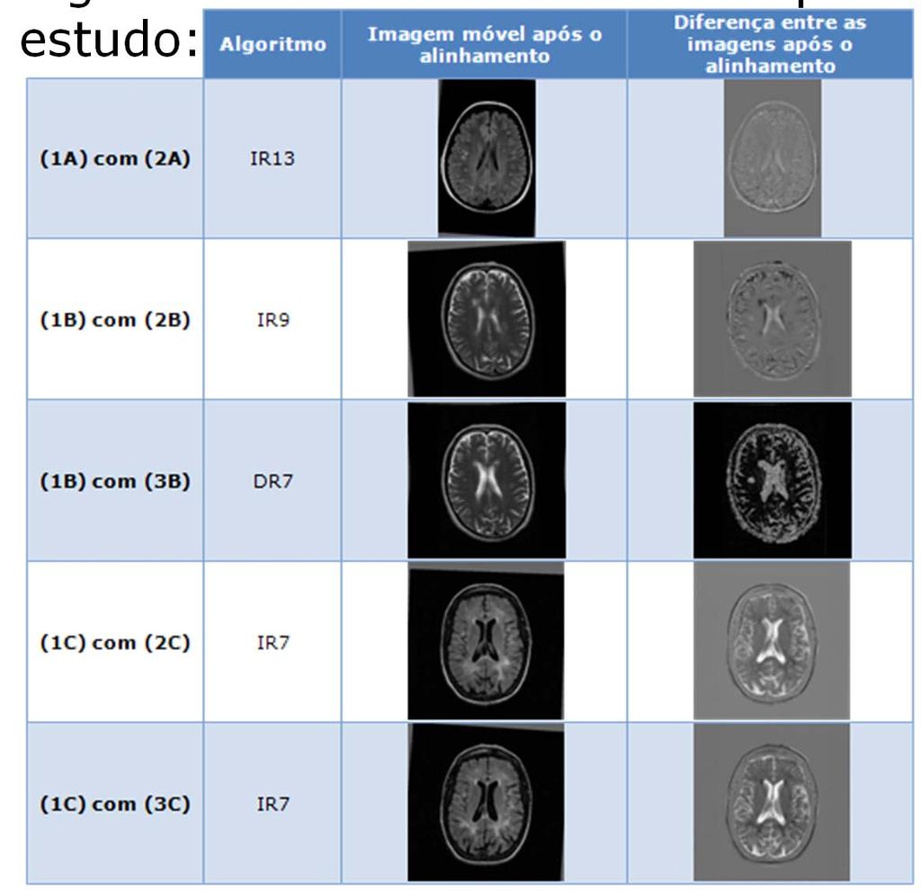 Resultados Alguns dos resultados obtidos após o alinhamento das imagens em estudo: Problemas: Tempos de processamento; Intensidades muito distintas entre as imagens; Algoritmos pouco maleáveis para o