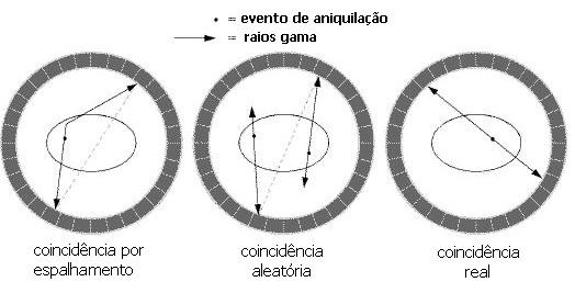 INTRODUÇÃO 23 FIGURA 24. Tipos de coincidências que podem ocorrer durante um exame de PET.