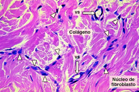 Tecido conjuntivo denso não-modelado Núcleos de fibroblastos (cabeças de