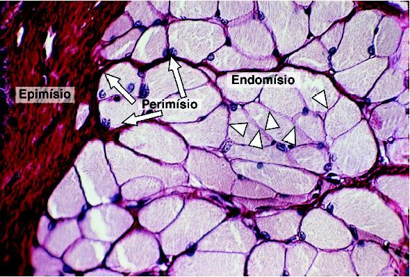 Tecido muscular esquelético corte transversal