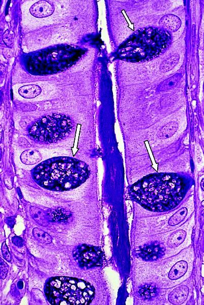 Epitélio simples cilíndrico com planura estriada e células caliciformes (Nesta lamina as céls
