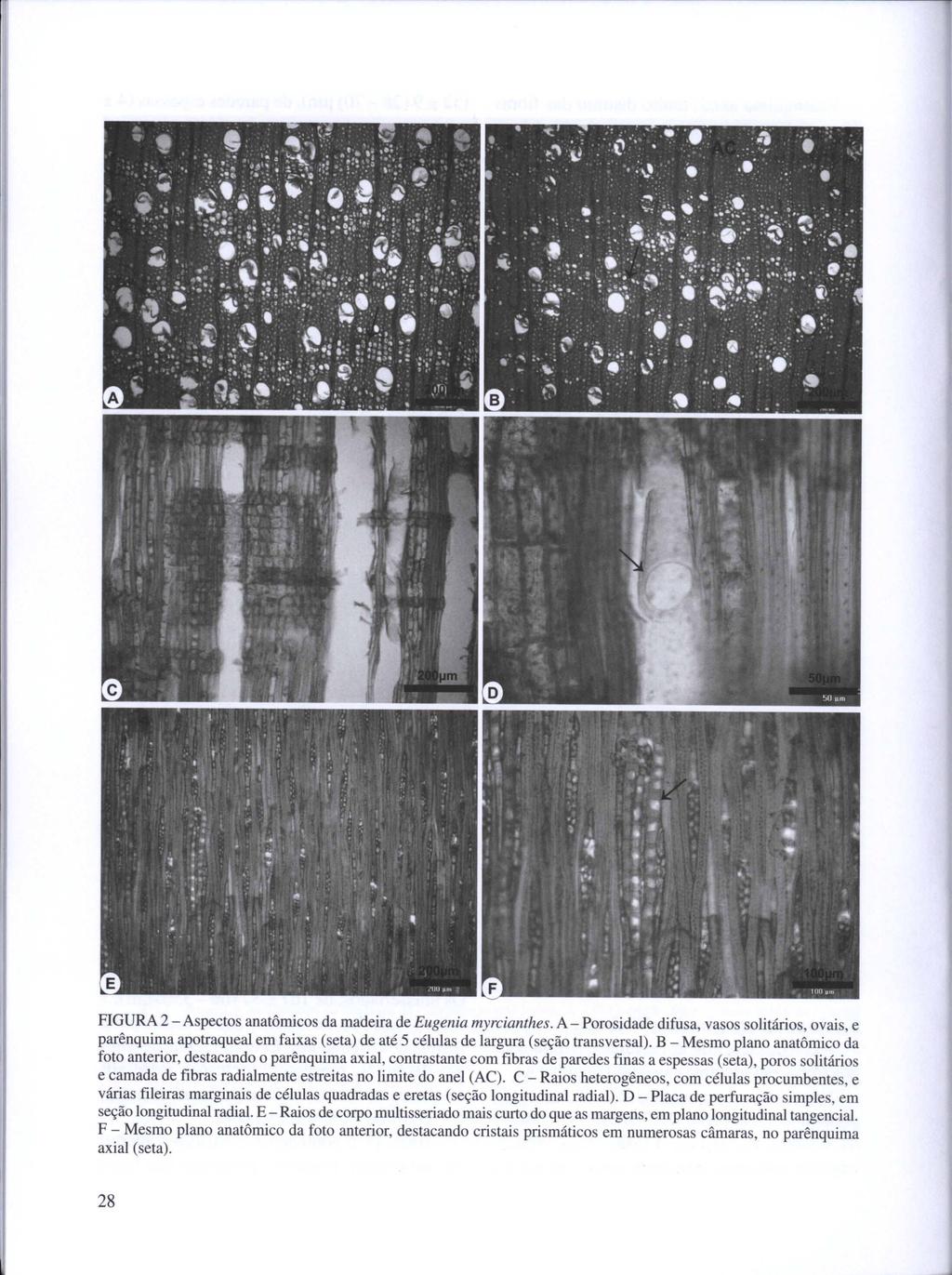 FIGURA 2 - Aspectos anatômicos da madeira de Eugenia myrcianthes.