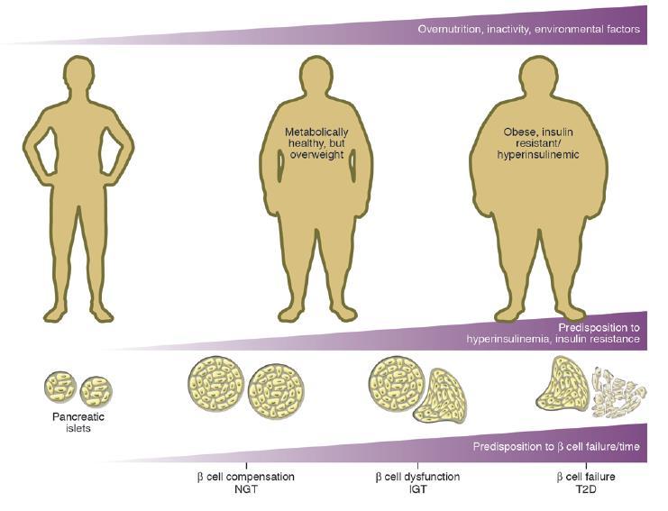 História natural do DM2: obesidade resulta em um aumento nas celulas ß e secreção de insulina, o que compensa a resistência à insulina.