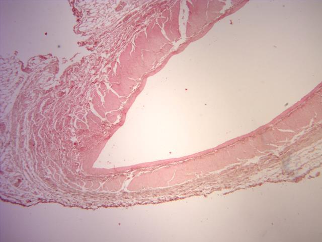 Artéria de Médio Calibre (Vide a FIG-1) As artérias de médio calibre, em sua grande parte no organismo, são as musculares e caracterizadas por uma espessa túnica média composta por células musculares