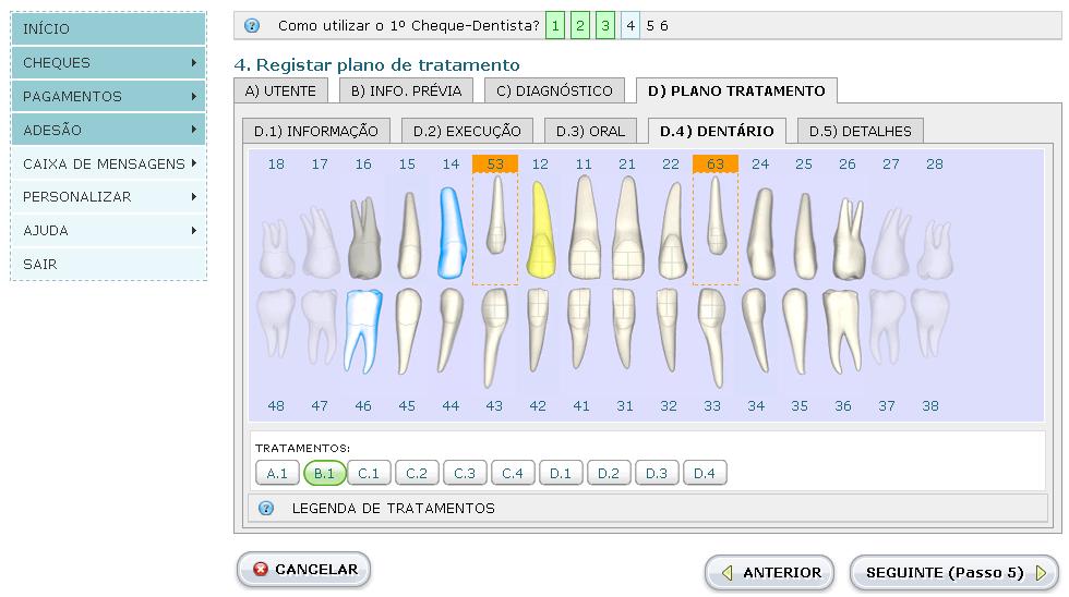 Campo Tratamentos Ação Selecionar o tratamento planeado aplicável na palete de opções e clicar sobre o(s) dente(s) pretendido(s) do odontograma.
