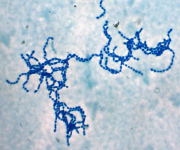 Figura 6 - Streptococcus pyogenes (colônia de cocos) Fonte: Dimarion/Shutterstock.com Figura 7 Colônia de bacilos bacterianos Fonte: Kateryna Kon/Shutterstock.