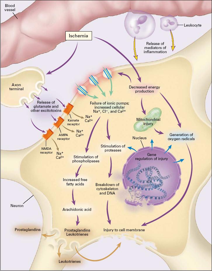 Interrupção do fluxo sanguíneo Diminui produção de energia Falência da bomba de Na + /K + Disfunção mitocondrial Acúmulo de