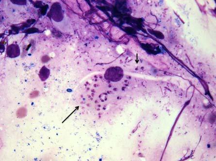 Ocorrência de Leishmania... citologia fecal revelou numerosas formas amastigotas de Leishmania sp.