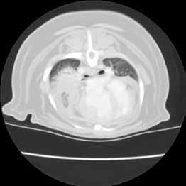 Efusão pleural Efusão pleural Difícil identificação da origem Muitas vezes e impossível a avaliação das estruturas da cavidade torácica na presença de efusão severa Maior sensibilidade, capaz de