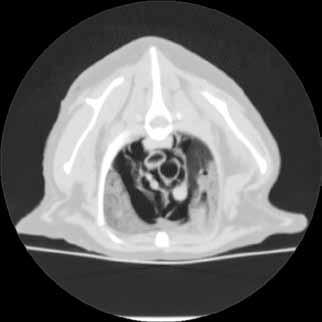 pneumotórax Diagnóstico preciso para fraturas e luxações de costela Melhor avaliação da extensão do trauma e definição terapêutica Modalidade de escolha na