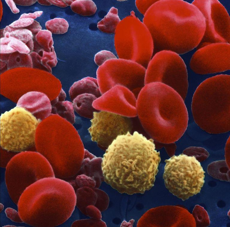 ELEMENTOS FIGURADOS São os seguintes: + Glóbulos vermelhos (hemácias ou eritrócitos); +