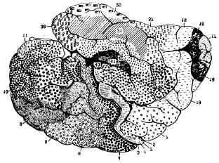 Figura 3.22 Cérebro humano (acima) e um neurônio deste, Haykin (2002).