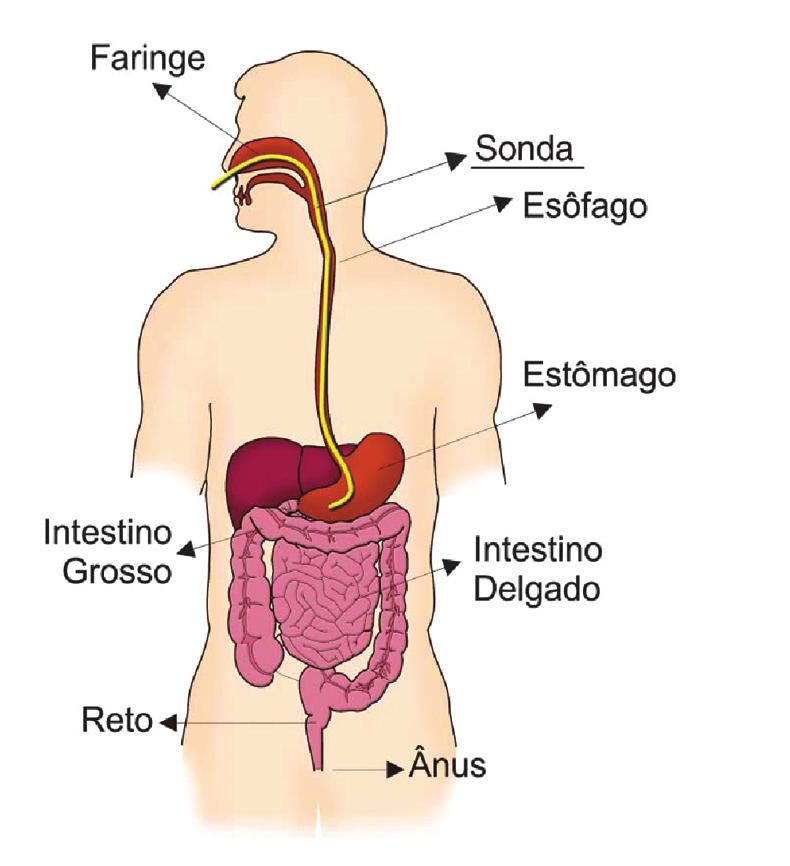 GASTROSTOMIA FIGURA