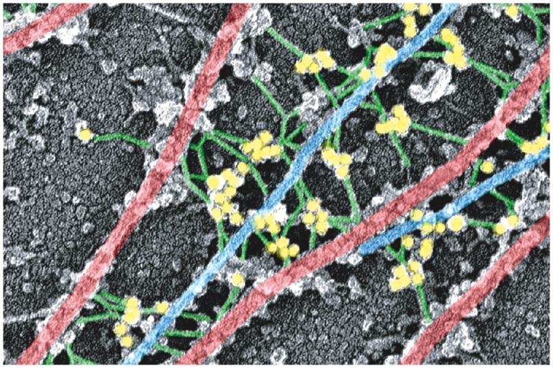 vermelho) e lamina (azul) amarelo-plectina Azul-filamentos intermediários Vermelho-microtúbulos Verde- fibras de conexão Microscopia eletrônica de fibroblasto corado com anticorpo anti-plectina.