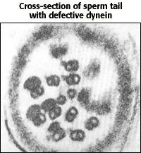 similar feita de microtubulos.