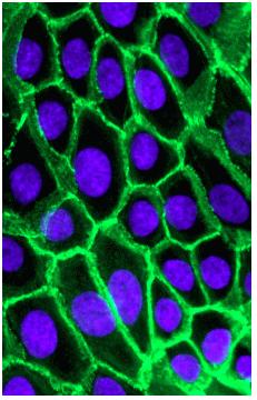 JUNÇÕES ADERENTES CADERINAS Interação Célula-Célula Image of human epithelial cells with cadherin stained green and nucleus blue.