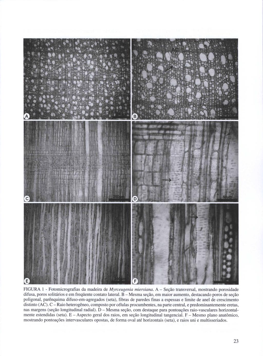 FIGURA I - Fotomicrografias da madeira de Myrceugenia miersiana. A - Seção transversal, mostrando porosidade difusa, poros solitários e em freqüente contato lateral.