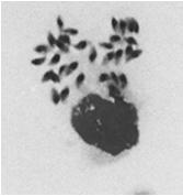 gondii Formas do parasito encontradas no Homem Taquizoítos Forma móvel Fase aguda Podem ser achados livres ou dentro de vacúolos parasitóforos de células em diversos órgãos e fluidos orgânicos Têm