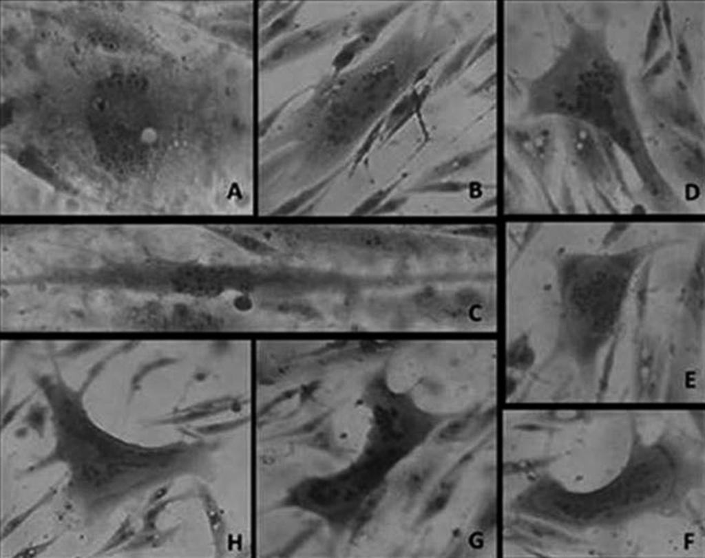 Produção de antígeno de lentivírus de pequenos ruminantes através da cultura celular de membrana nictitante caprina (1998), os quais utilizaram células de MSC.