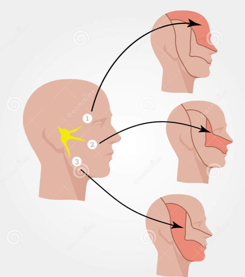 NERVO TRIGÊMIO O nervo trigêmeo é o V (quinto) par craniano, tem três