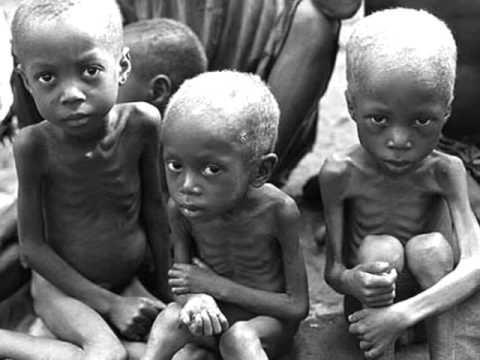 Desnutrição Marasmática Kwashiokor Marasmática-kwashiokor Fome