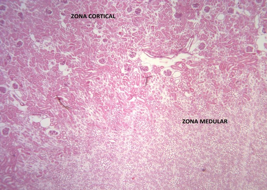 Zona Cortical; Zona Medular Corpúsculo renal Formado por glomérulo (conjunto de capilares) + cápsula glomerular.