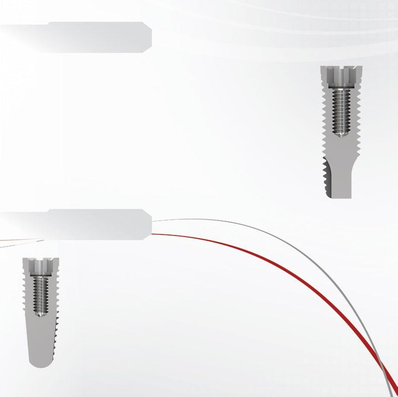 HI Cilíndrico Plataforma Ø 4,1 mm (implantes de Ø 3,75 e 4 mm), Ø5 mm (implantes de Ø5 mm) Rosca interna Ø 1,8 mm Instalação por meio de chave de inserção (sem montador) Única medida para encaixe dos