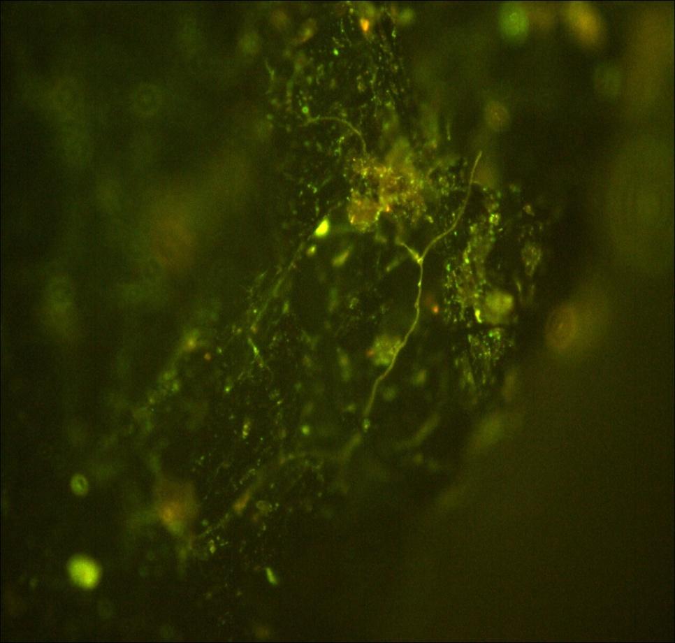 A MICROBIOTA EM CARVÃO PIROGÊNICO Hifas de fungos estão na superfície de uma partícula de C-pirogênico Fluorescência Imagem por microscopia Fluorescência demonstra a