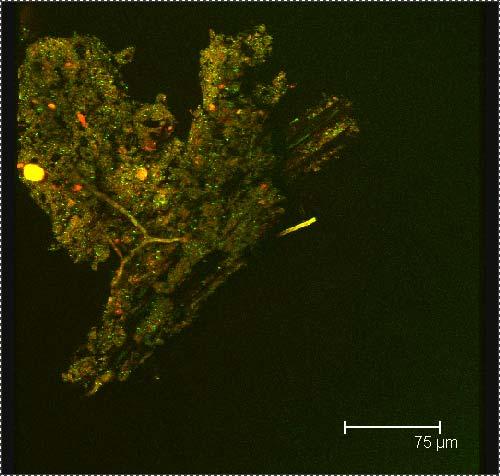 A MICROBIOTA EM CARVÃO PIROGÊNICO Corante verde indica presença de organismos vivos Confocal Imagem por microscopia confocal demonstra a presença de