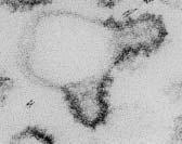 Vesículas cobertas permitem direcionar conteúdos distintos para cada organela. 3 tipos: Vesículas cobertas por clatrina da membrana plasmática e do trans-golgi para os endossomos.