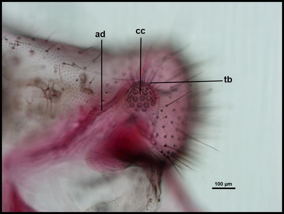 31 Figura 13. Vista lateral do ápice do abdome do macho de Leucochrysa (Nodita) postica (Navás) (Reserva Biológica de Sooretama, Linhares, Espírito Santo).