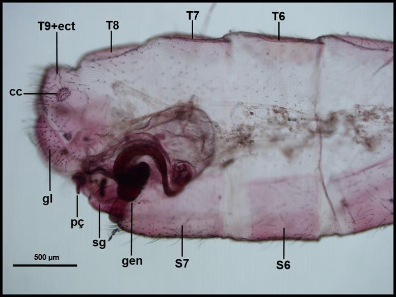 34 Figura 17. Segmentos terminais do abdome da fêmea de Leucochrysa (Nodita) postica (Navás) em vista lateral (Reserva Biológica de Sooretama, Linhares, Espírito Santo).