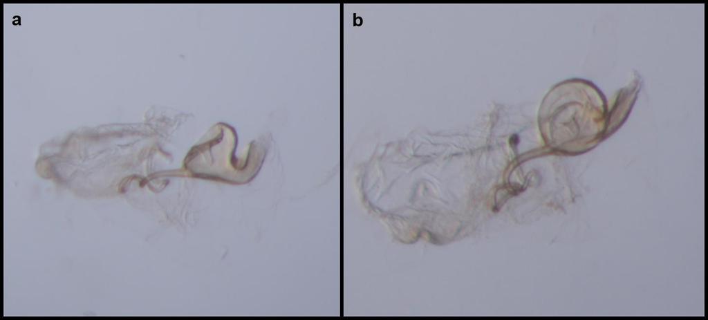 66 Genitália : comparando com as imagens do holótipo (fêmea) constantes do banco de imagens digitalizadas dos tipos de Chrysopidae (G.S.