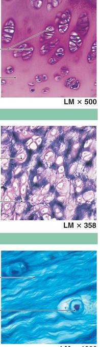 Tipos de Cartilagem Cartilagem Hialina Colágeno II, GAG, proteoglicanas e glicoproteinas (nariz e costelas)