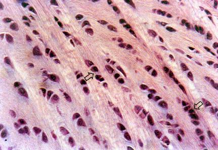 br/mol/6-9-cart-fibrosa1.