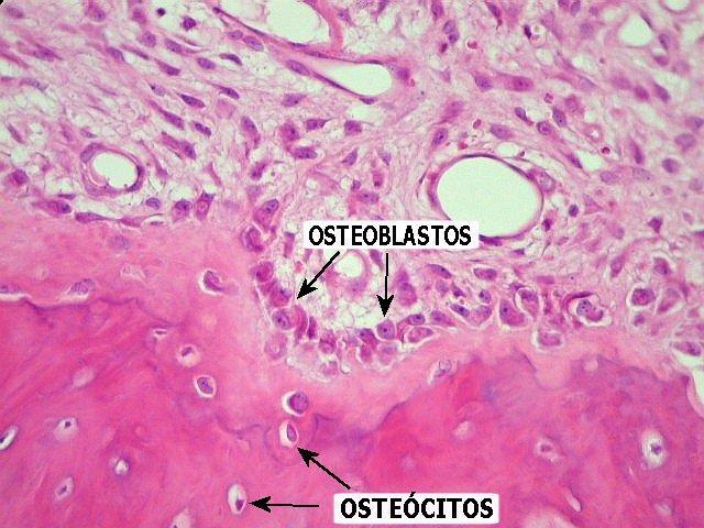 Osteócitos http://www.lookfordiagnosis.