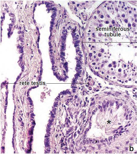 apical único Túbulos Retos Túbulos