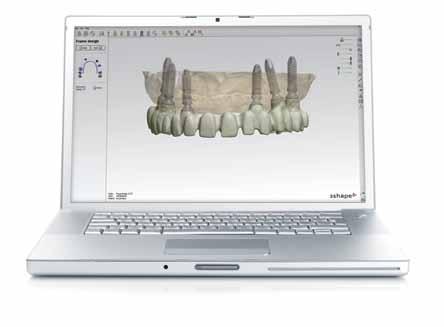 O scanner modelo D700 proporciona precisão micrométrica por realizar uma leitura a laser em 5 planos diferentes e sem contato humano.