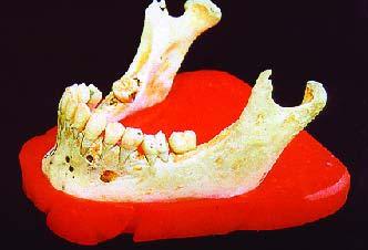 ramante S et al o dente afetado, é verificada até hoje (1-4).