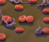 Doença de Chagas e malária Triatoma infestans (barbeiro) Transmissor (vetor) Agentes Trypanosoma cruzi Etiológico (causador) Fezes do