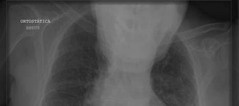 radiografia. Cada um tem a sua forma de avaliar o exame, mas uma sistematização deve sempre ser adotada.