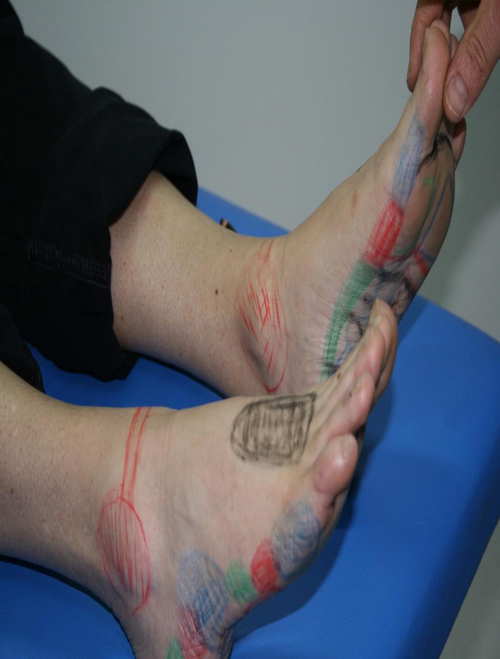 Reflexologia dos pés e seu uso na APS Face interna dos pés representação