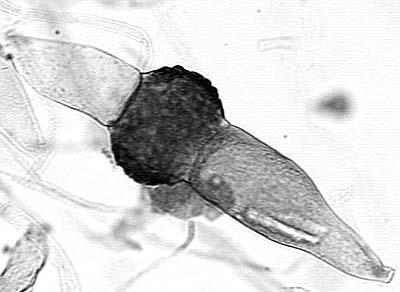 Filo Zygomycota botit.botany.