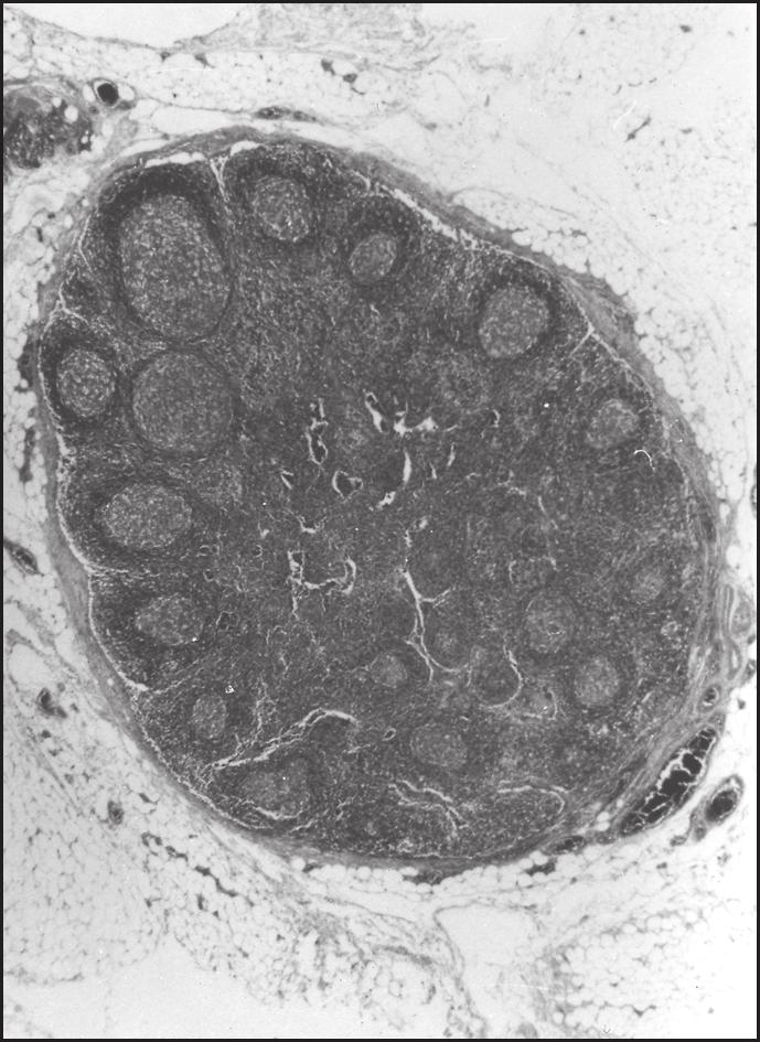 Capítulo 1 Conceitos Básicos em Imunologia 19 Linfonodo Seio cortical Folículo linfoide secundário (com centro germinal) Vaso linfático aferente Área paracortical (maioria de células T) Centro