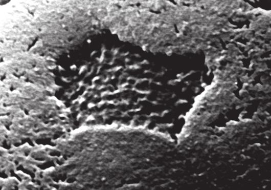 Capítulo 1 Conceitos Básicos em Imunologia 21 As placas de Peyer são cobertas por uma camada epitelial que contém células especializadas chamadas células M, as quais apresentam características de