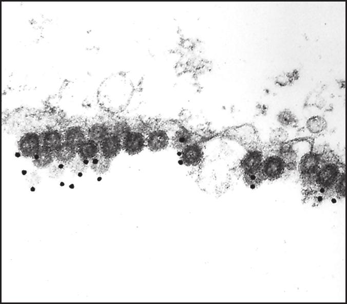 Capítulo 1 Conceitos Básicos em Imunologia 29 a Célula infectada por vírus Célula infectada Vírus b Célula T citotóxica mata a célula infectada Célula infectada morta T Mata V T c Célula T citotóxica